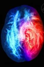 Watch Brain on Fire Zmovies