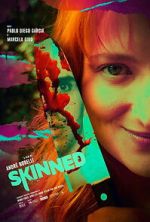 Watch Skinned Zmovies