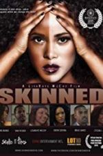 Watch Skinned Zmovies