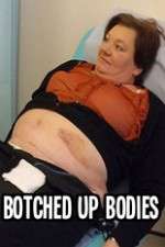 Watch Botched Up Bodies Zmovies