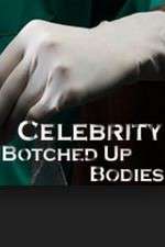 Watch Celebrity Botched Up Bodies Zmovies